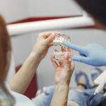 Jak mocowana jest proteza zębowa elastyczna?