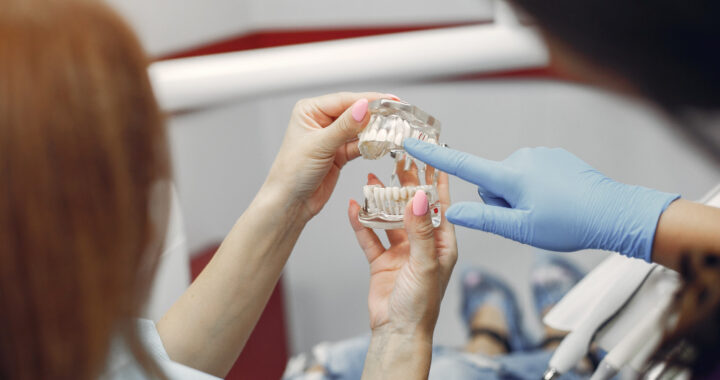 Jak mocowana jest proteza zębowa elastyczna?