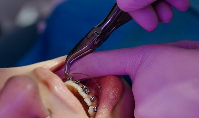 Jak często trzeba chodzić do ortodonty?