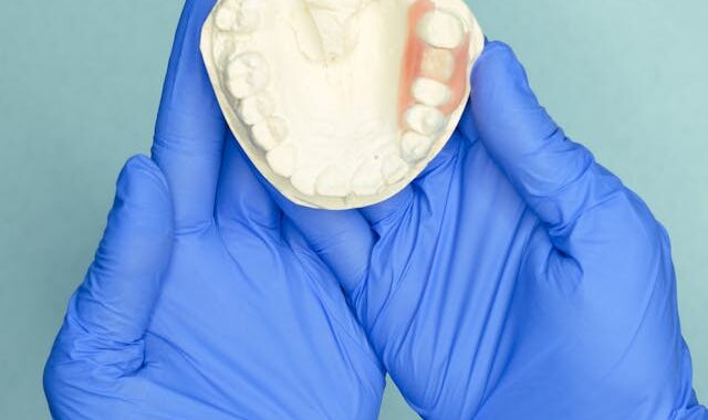 Czy proteza All on 4 wygląda naturalnie?