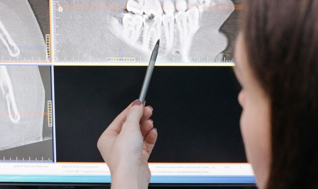 Czy wynik tomografii stomatologicznej otrzymuje się od razu?